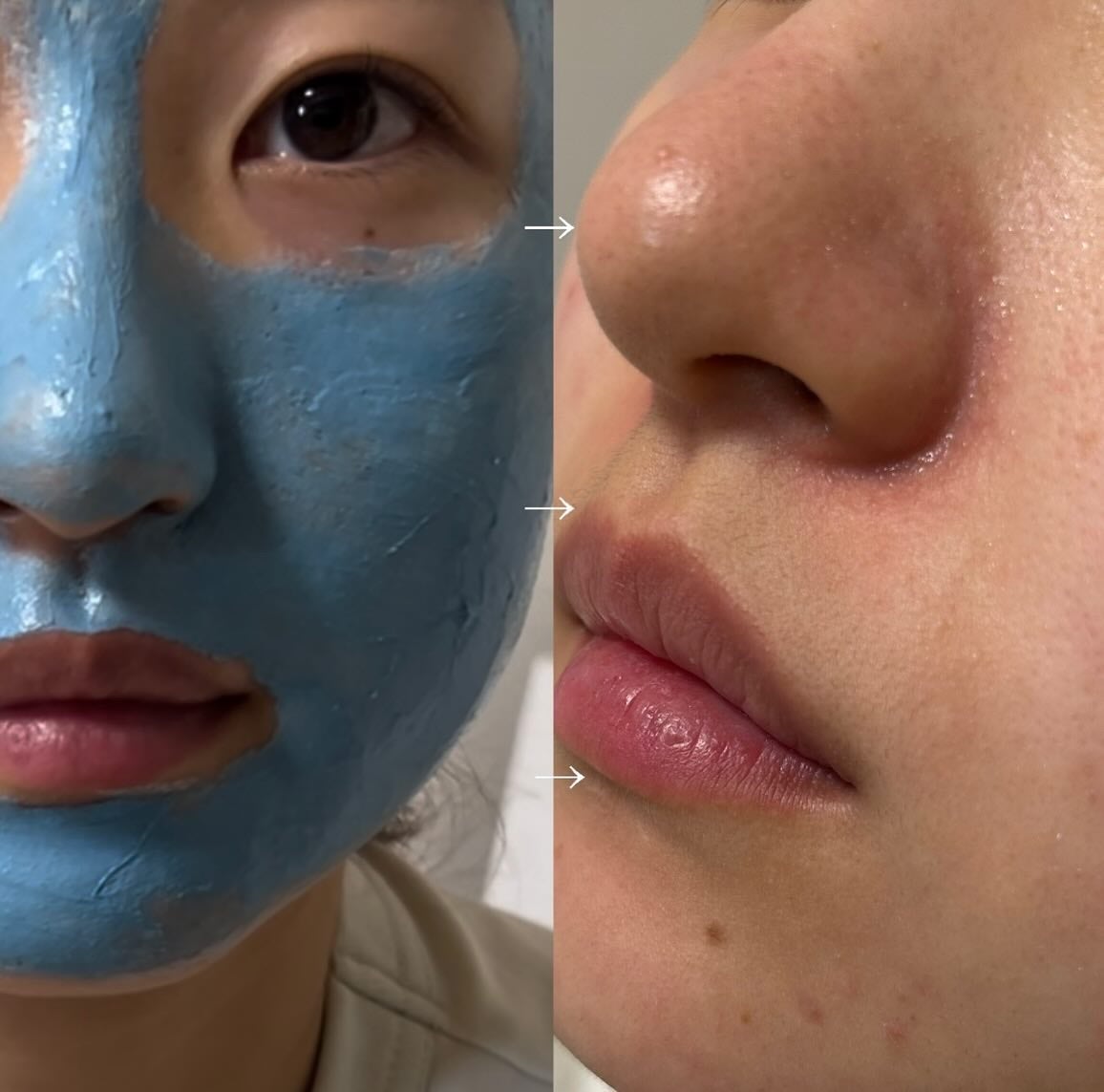 ゼロ毛穴クレイパック/MEDICUBE/洗い流すパック・マスクを使ったクチコミ(3枚目)