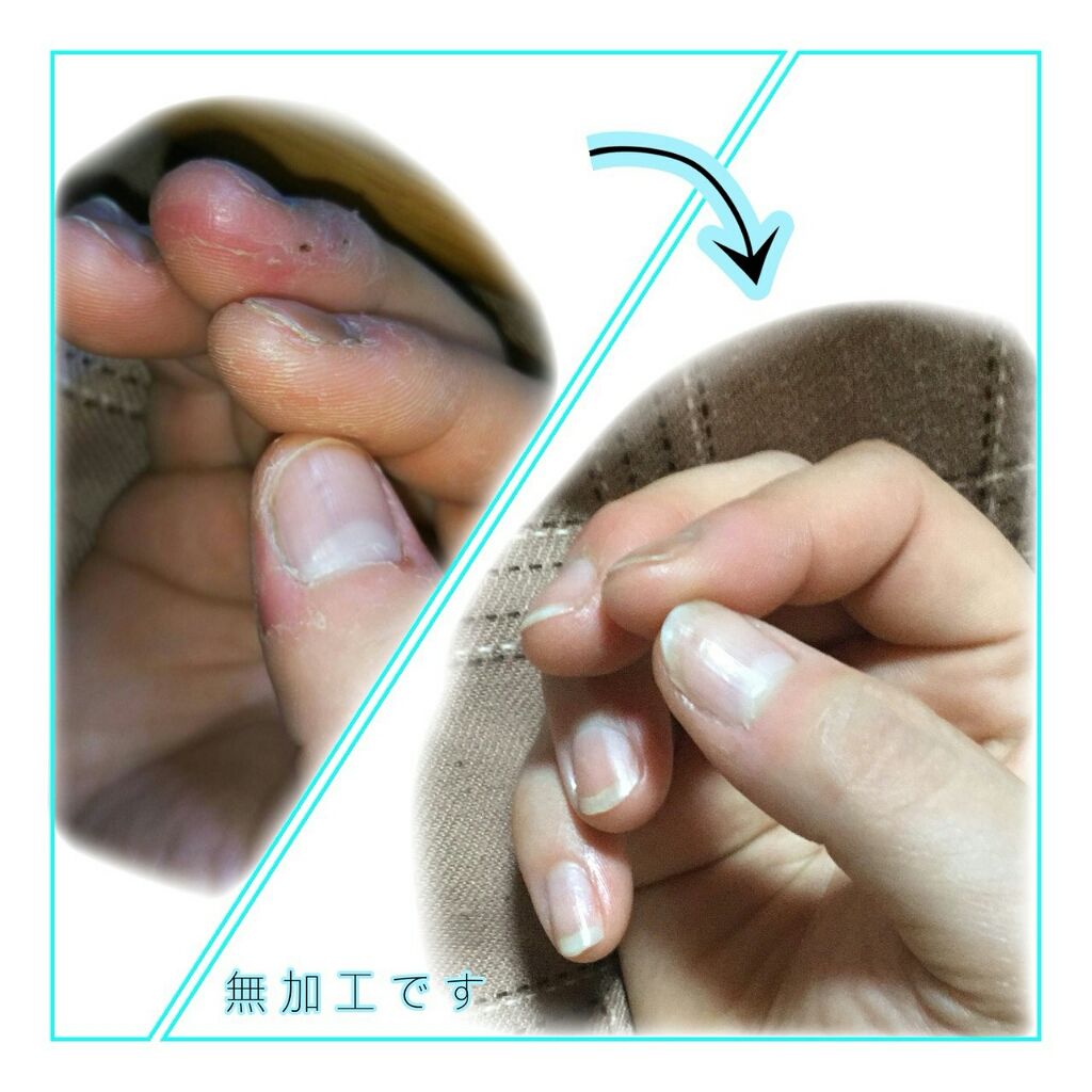 フラワーネイルオイル/JILL STUART/ネイルオイル・トリートメントを使ったクチコミ（3枚目）