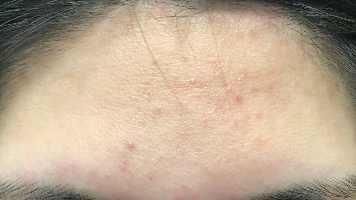 紙一重 on LIPS 「⚠️2枚目お肌注意..」(2枚目)