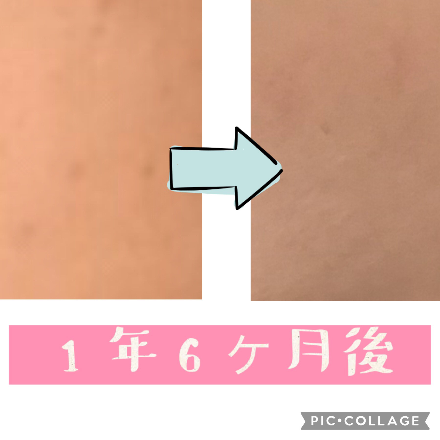 スキンアクア トーンアップUVエッセンス/スキンアクア/日焼け止めクリームを使ったクチコミ（2枚目）