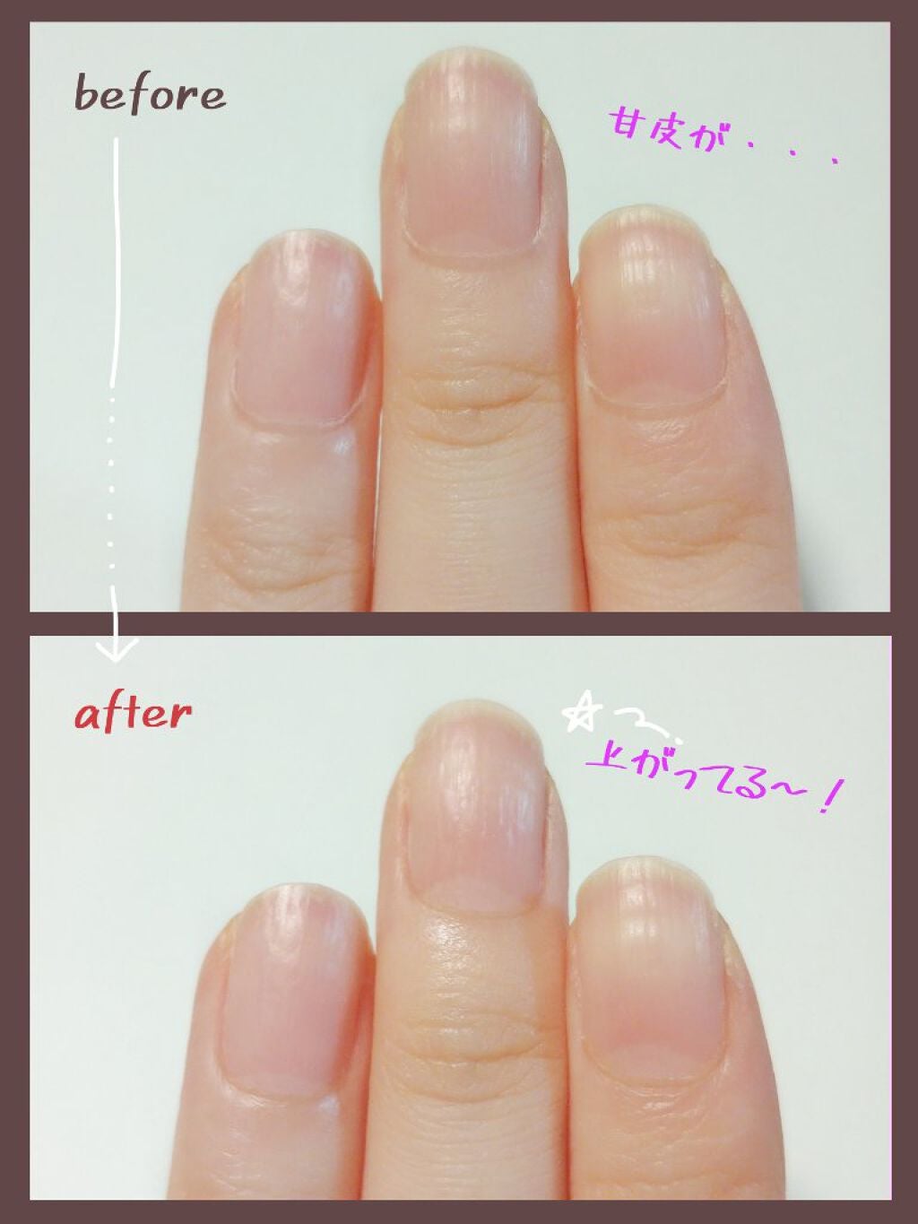 キューティクルトリマー/デュカート/ネイル用品を使ったクチコミ(3枚目)