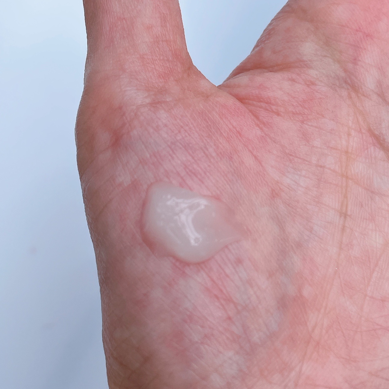 ゼロ1DAYエクソソームショット7500/MEDICUBE/美容液を使ったクチコミ（3枚目）