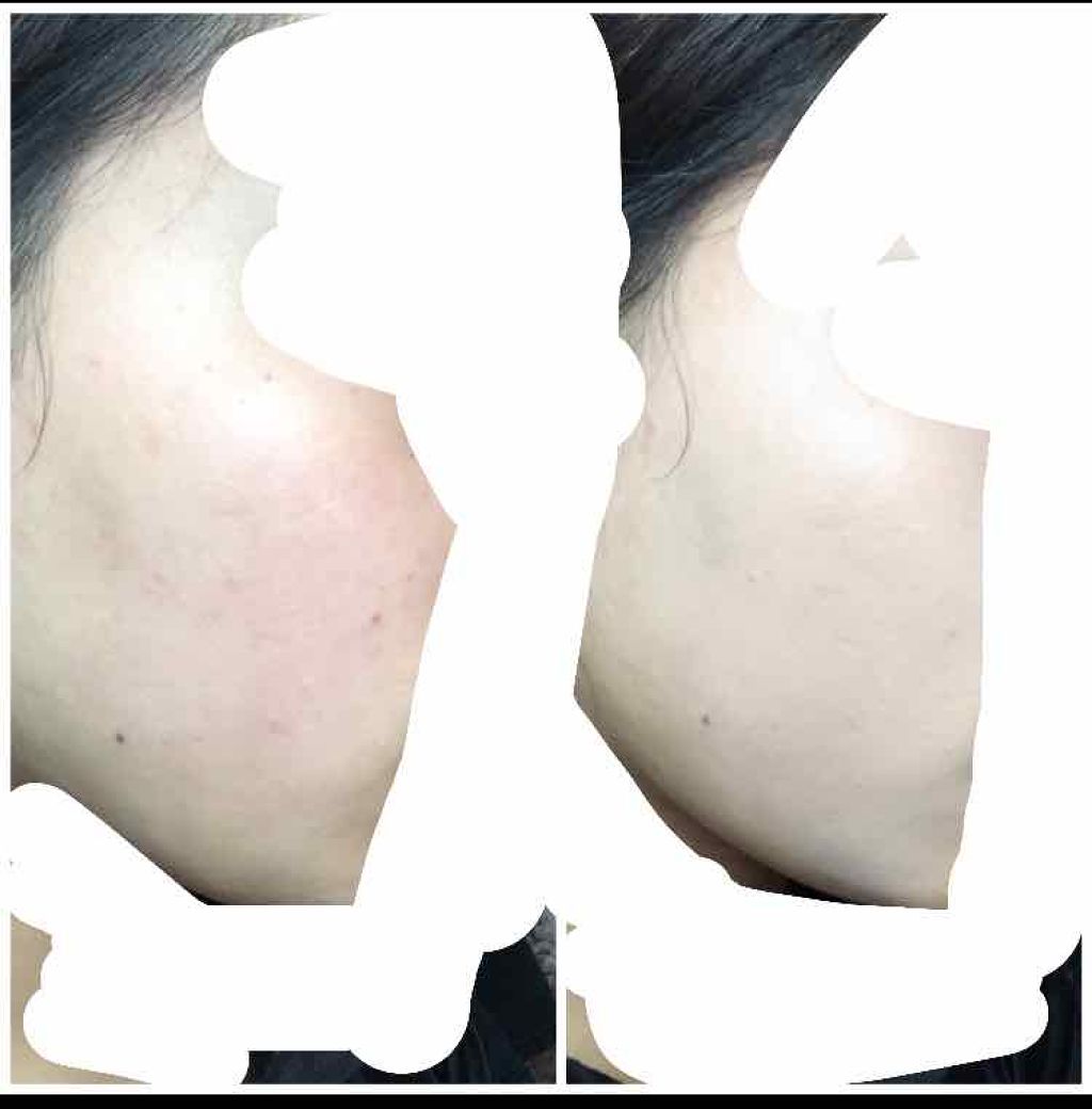 キル カバー ファンウェア クッション エックスピー/CLIO/クッションファンデーションを使ったクチコミ(2枚目)