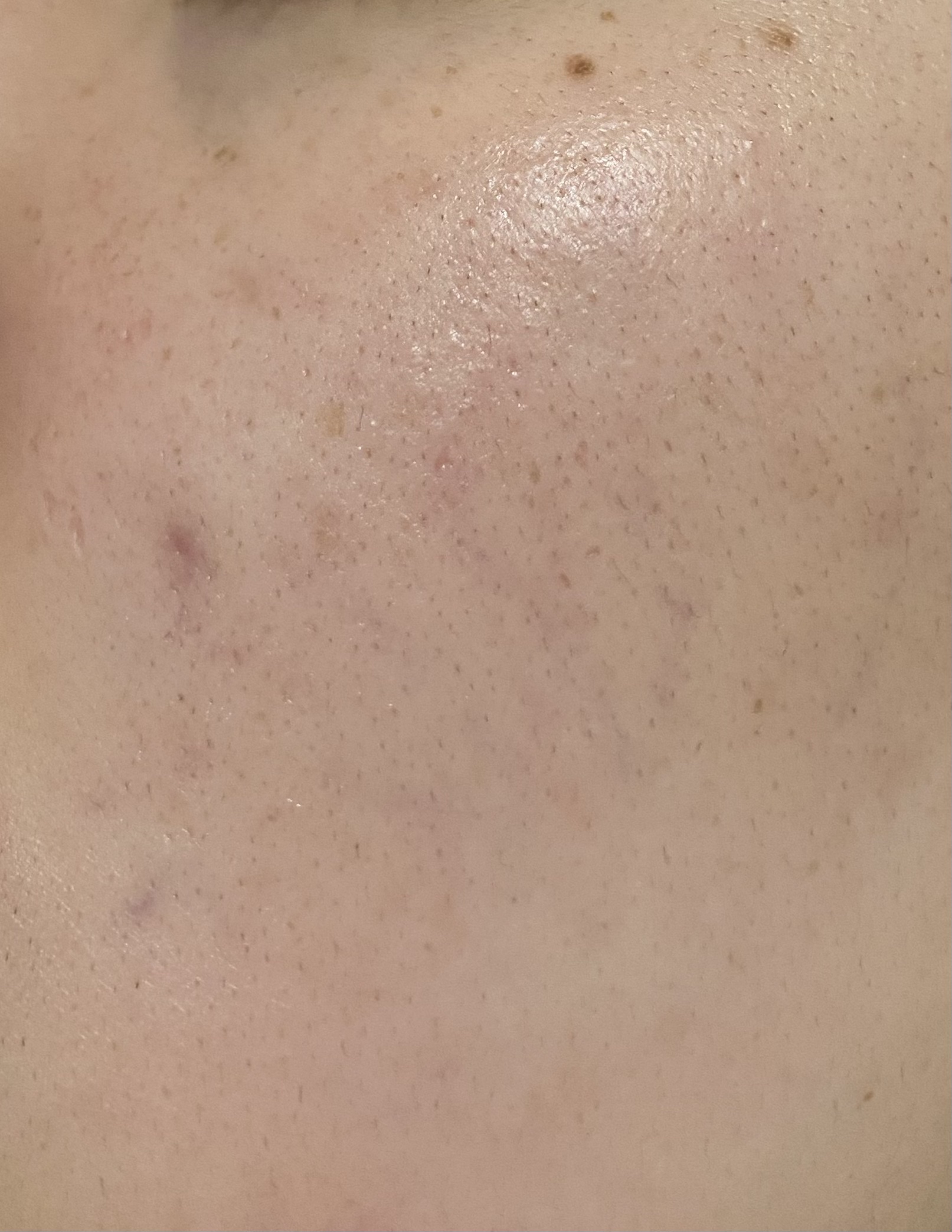 乾燥小じわ対策 肌ふっくらマスク/クリアターン/シートマスク・パックを使ったクチコミ（2枚目）