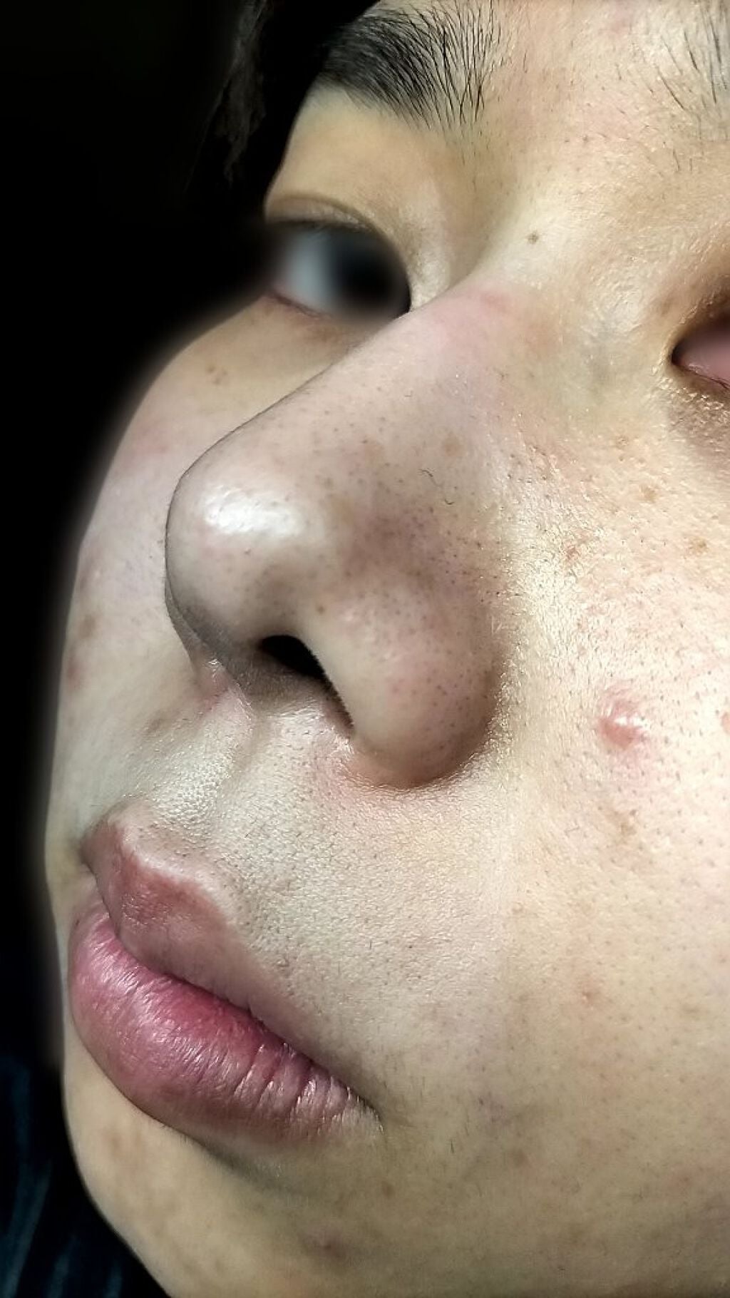 NITENA/LOABI/美顔器・マッサージを使ったクチコミ(4枚目)