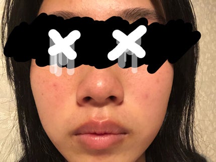 艶肌ドロップ/ラッシュ/美容液を使ったクチコミ(3枚目)