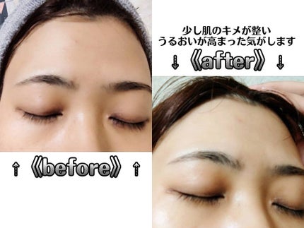 PLUMINUS/mous./美顔器・マッサージを使ったクチコミ(4枚目)