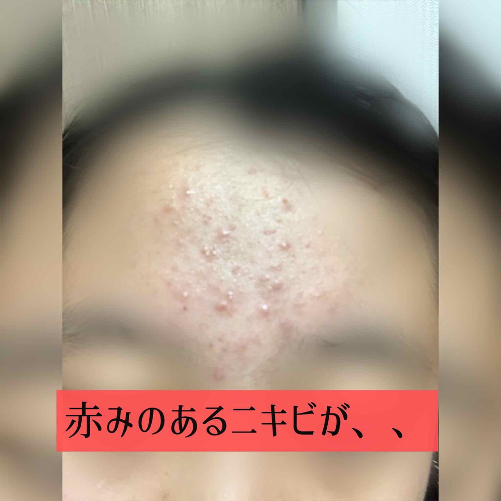 化粧水・敏感肌用・高保湿タイプ/無印良品/化粧水を使ったクチコミ(2枚目)