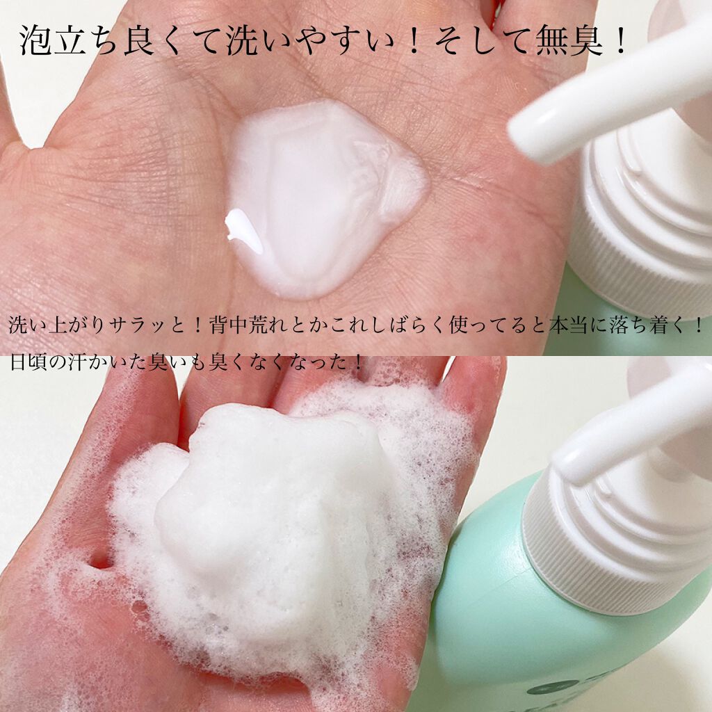 クリアレックスWi/第一三共ヘルスケア/ボディソープを使ったクチコミ(3枚目)