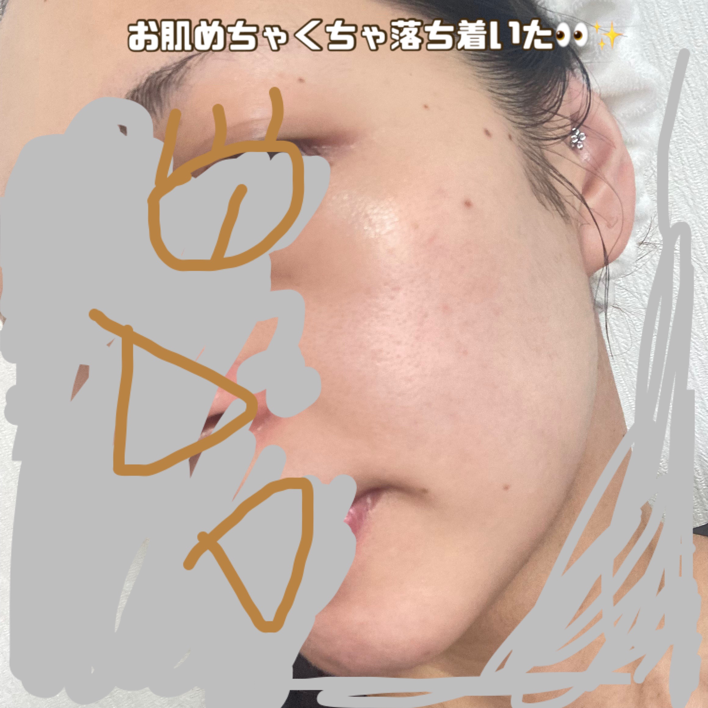 センテラ アンプル/SKIN1004/美容液を使ったクチコミ（3枚目）