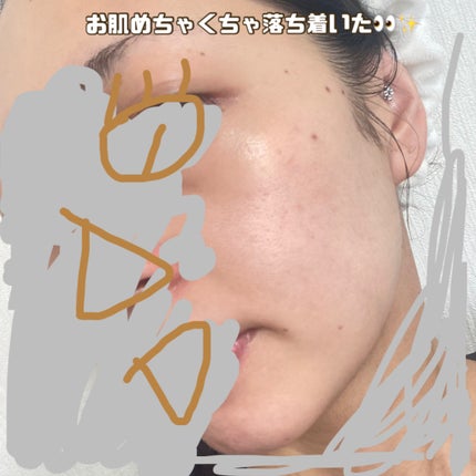 センテラ アンプル/SKIN1004/美容液を使ったクチコミ(3枚目)