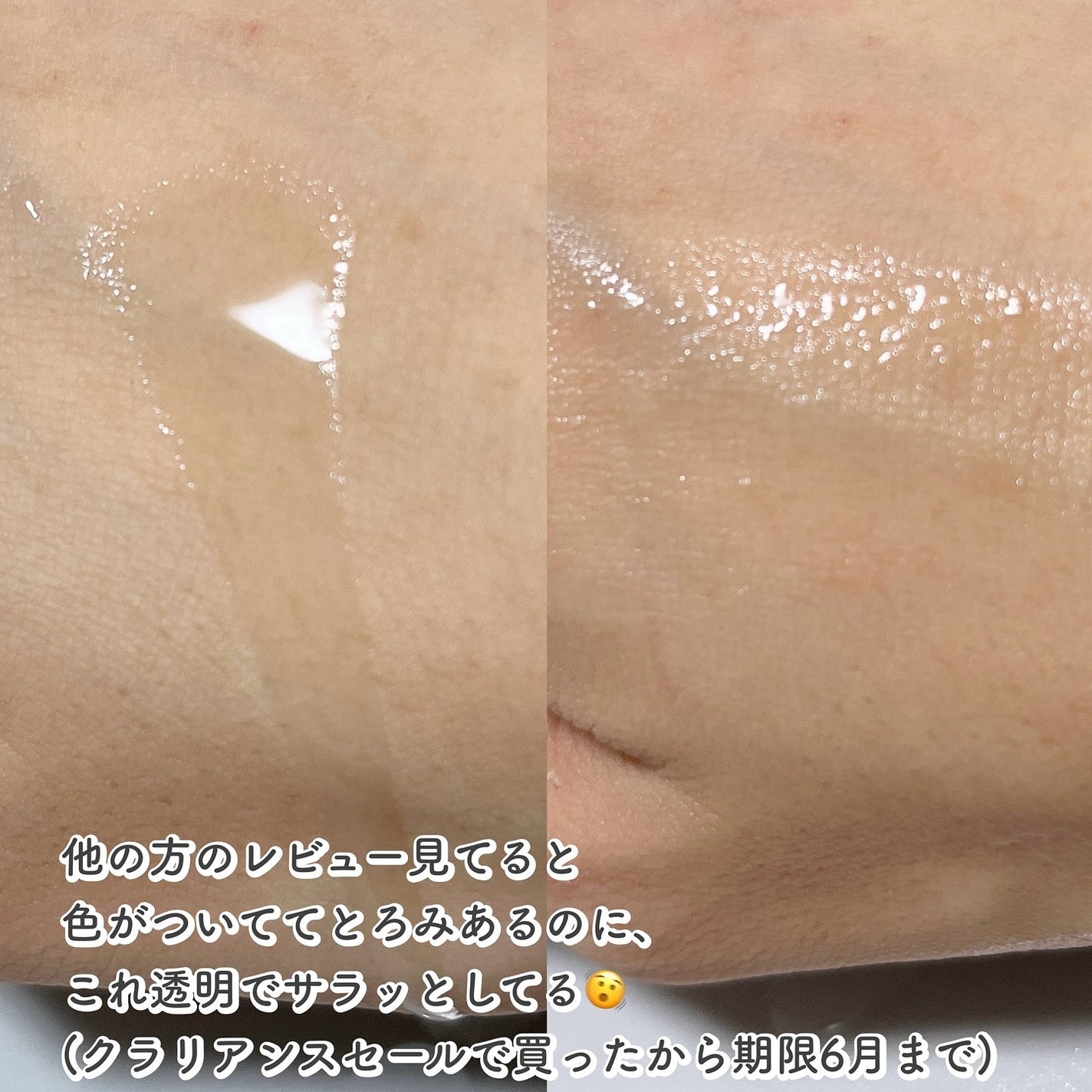 ビフィダバイオームコンプレックスセラム/manyo/美容液を使ったクチコミ(3枚目)