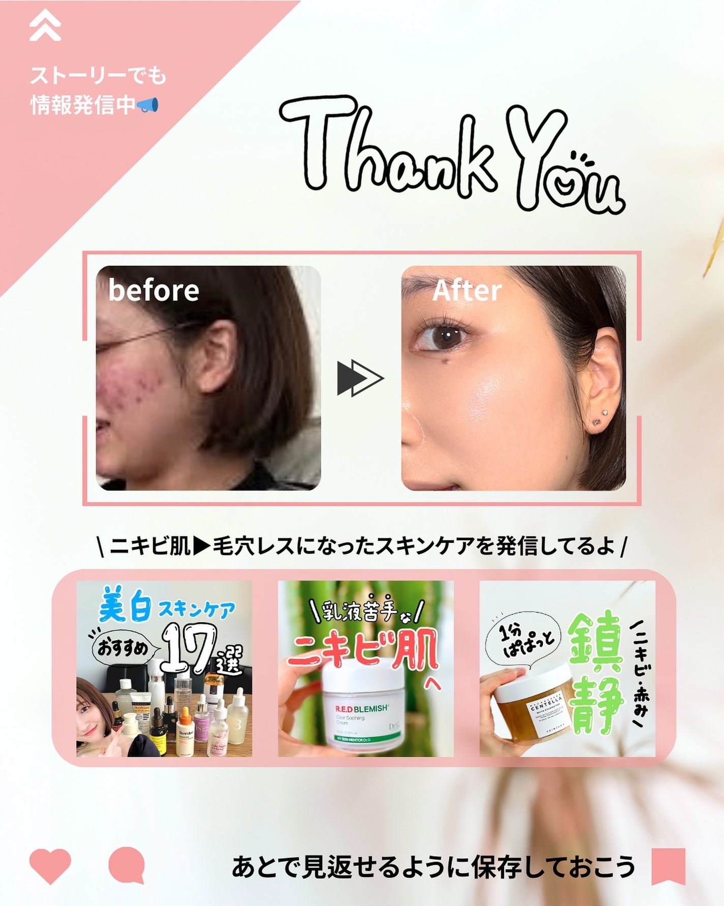 なぎ | スキンケア薬剤師 on LIPS 「保存推奨!ニキビに悩んだらこれ💡こんばんは、なぎです✨ニキビ商..」(10枚目)