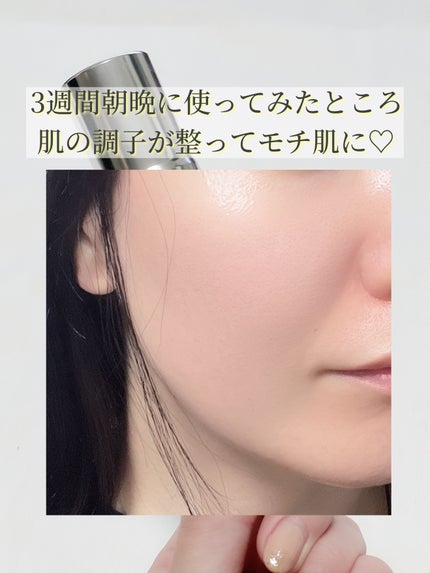 エージプロテオム/エステダム/美容液を使ったクチコミ(4枚目)