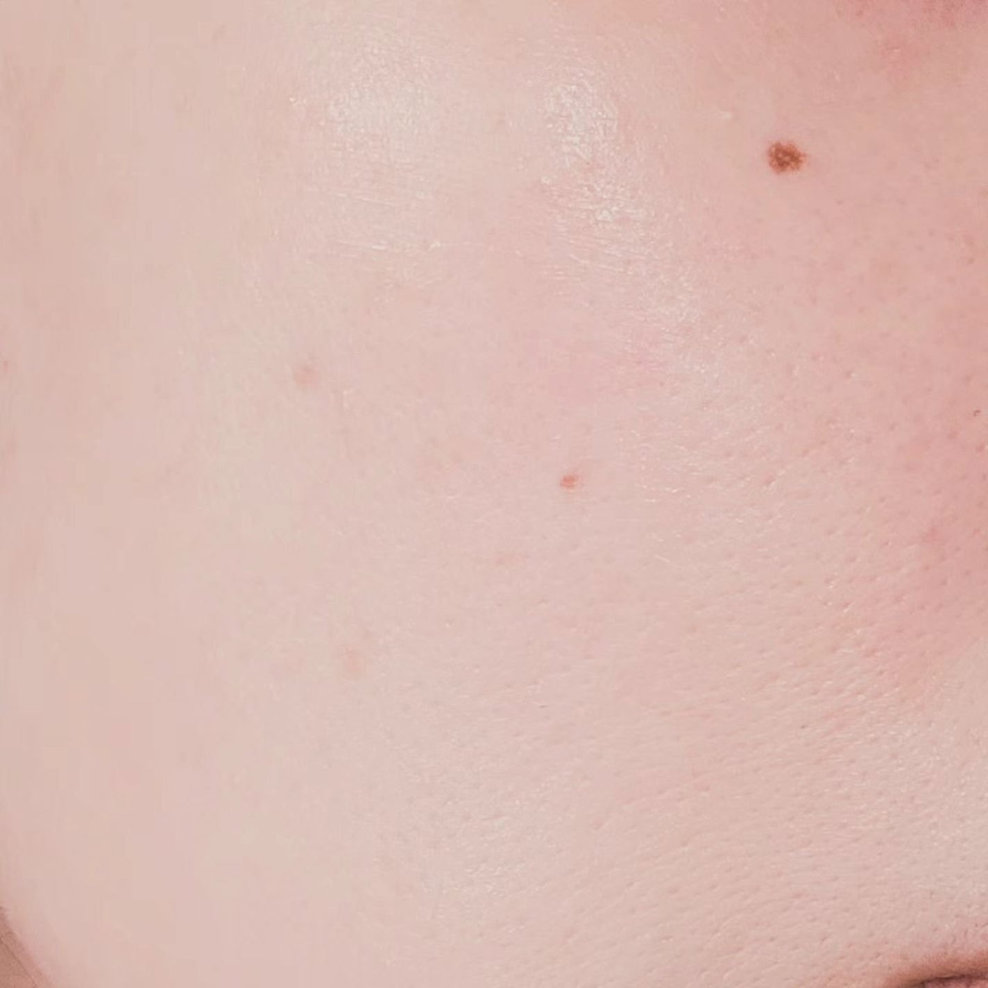 爆弾クリーム/ビリーフ/フェイスクリームを使ったクチコミ(7枚目)