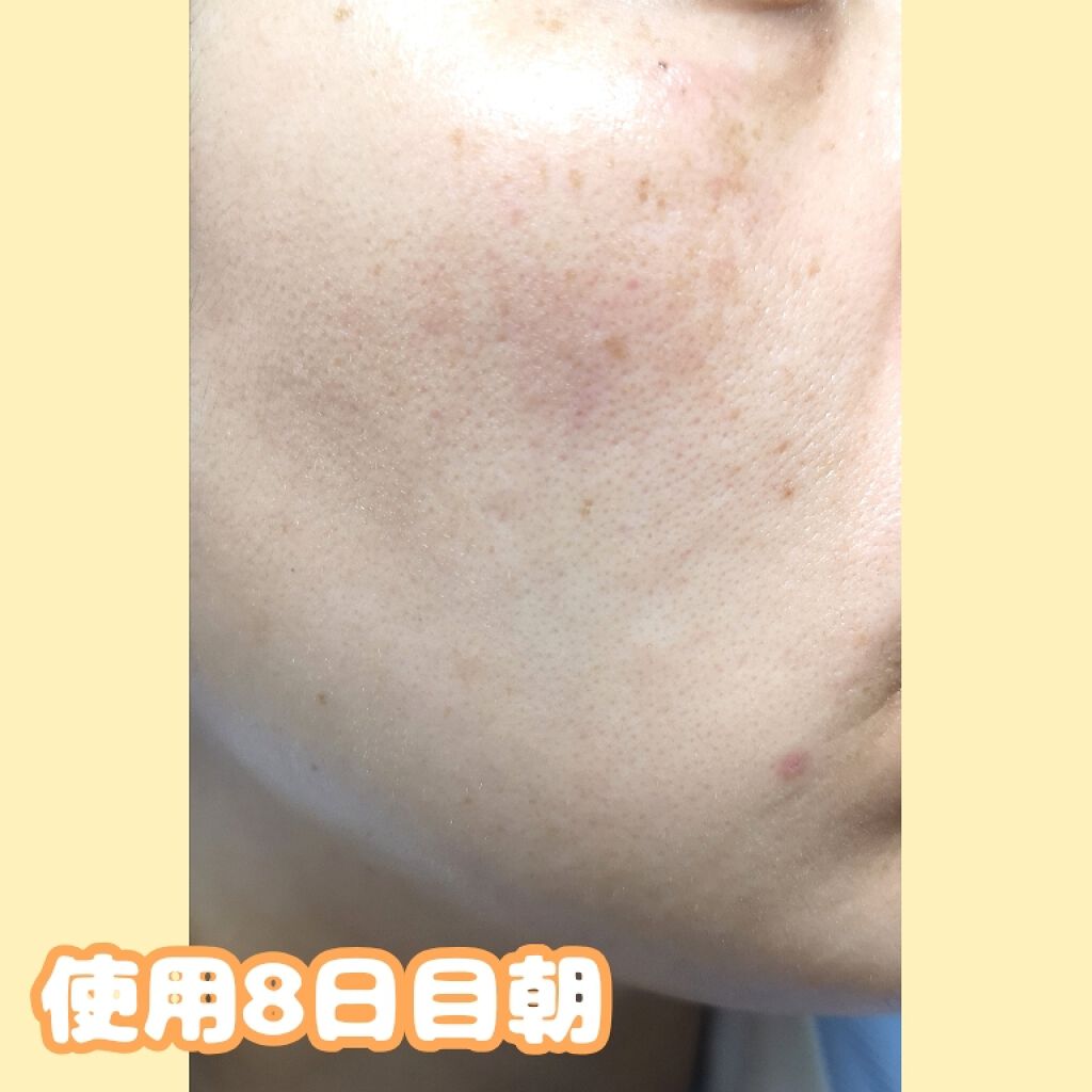 ホワイトニングクリアエマルジョン/d プログラム/乳液を使ったクチコミ（2枚目）