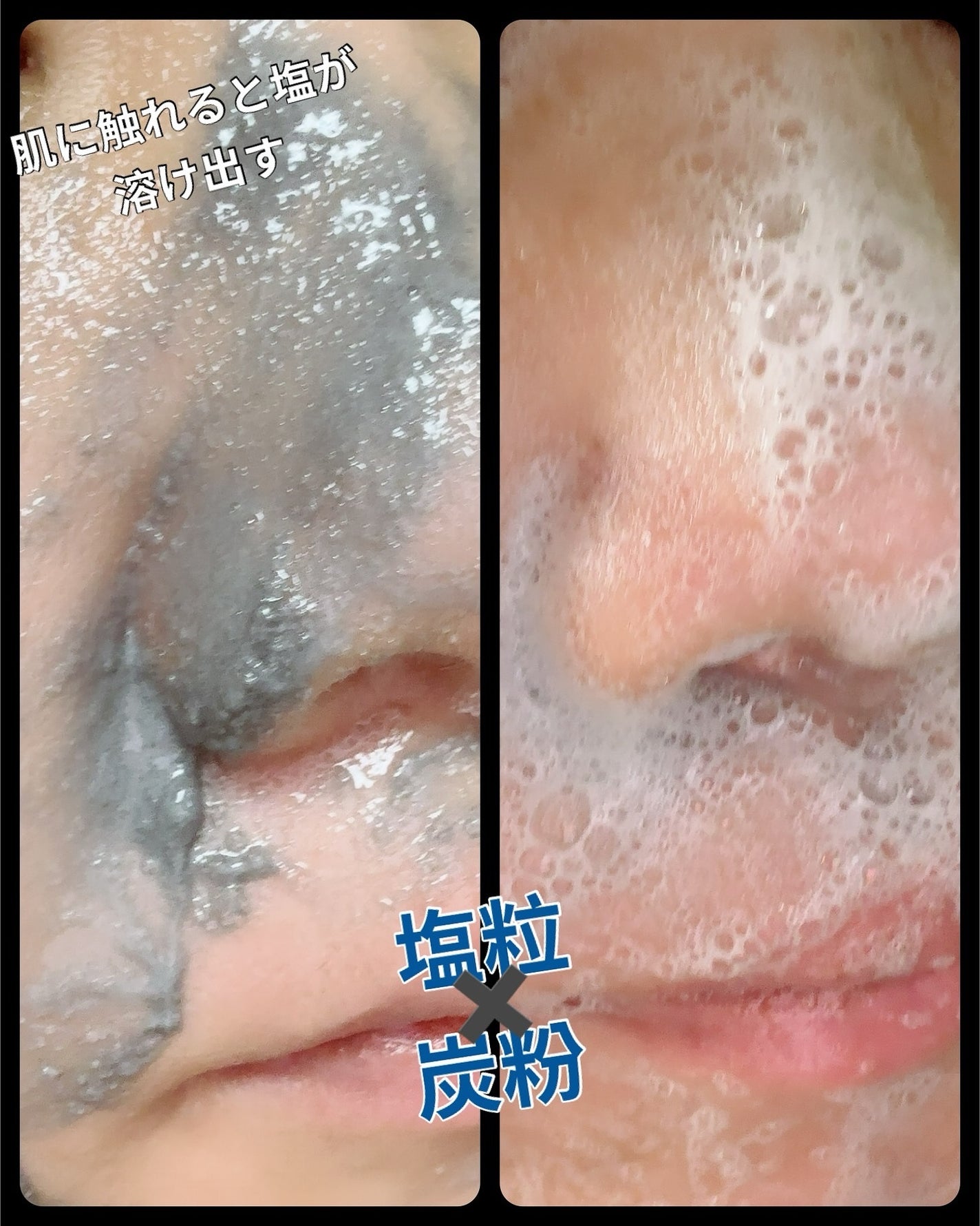 ちゃんぶぅ 投稿ある方フォロバします💕 on LIPS 「皮脂ケア、毛穴ケアにおすすめの『Torhop ブラック泡クレン..」(2枚目)