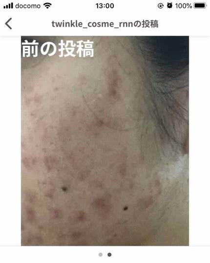 を使ったクチコミ(2枚目)