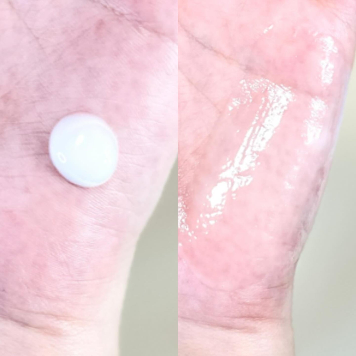 アゼペア 美容液/ネイチャーリパブリック/美容液を使ったクチコミ(2枚目)