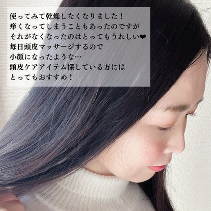 チャップアップ育毛ローション/CHAP UP(チャップアップ)/頭皮ローションを使ったクチコミ(6枚目)