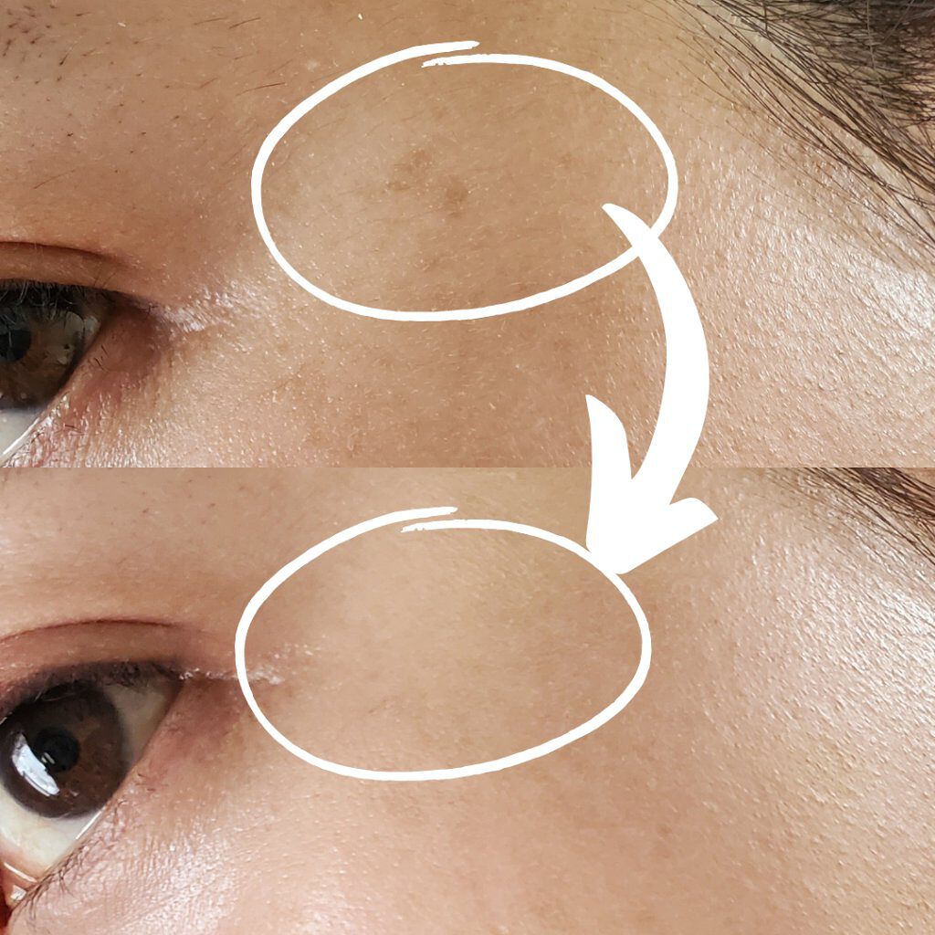 カバーパーフェクション チップコンシーラー/the SAEM/リキッドコンシーラーを使ったクチコミ（2枚目）