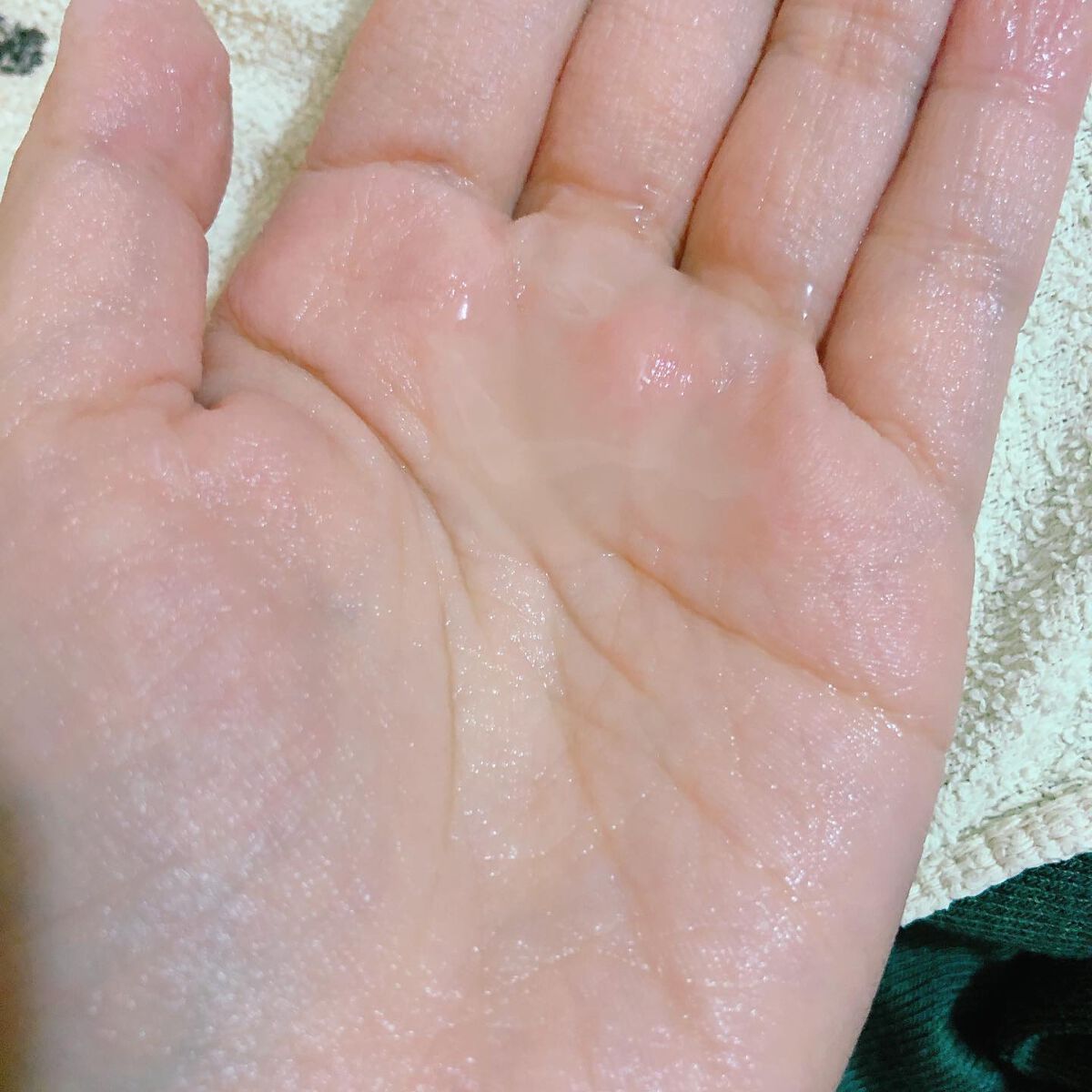 1st.バイオトリートメントS/BIOFEAT. /美容液を使ったクチコミ（3枚目）