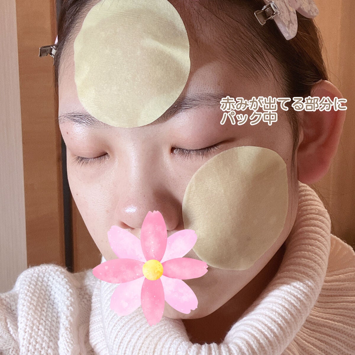 AC コントロール EX ディープ グリーン カーミング パッド 60枚入 /DEWYTREE/トナーパッドを使ったクチコミ(3枚目)