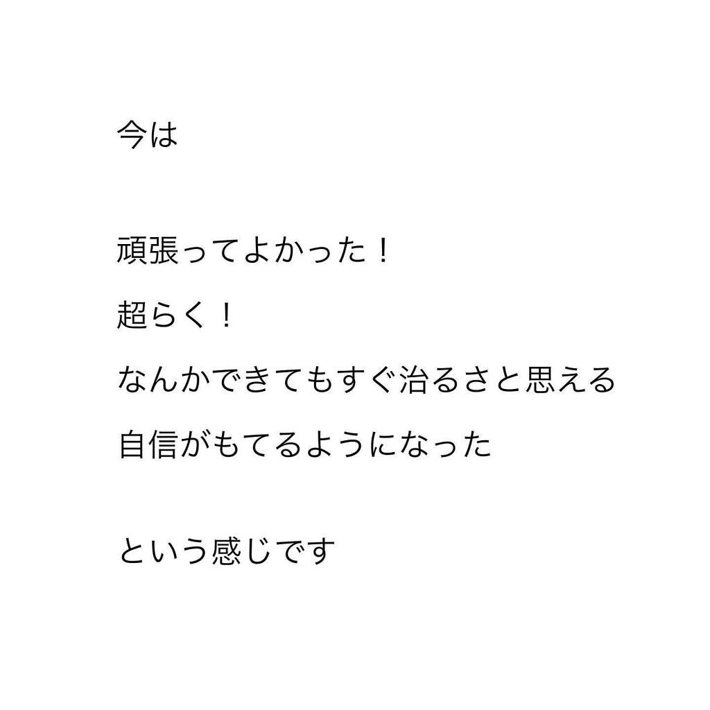 スキンケア/肌改善/yukari.Oka on LIPS 「メイク以外でツヤ肌になる方法ツヤ肌になりたい場合2つの方法があ..」(7枚目)