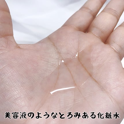 オイデルミン エッセンスローション/SHISEIDO/化粧水を使ったクチコミ(3枚目)