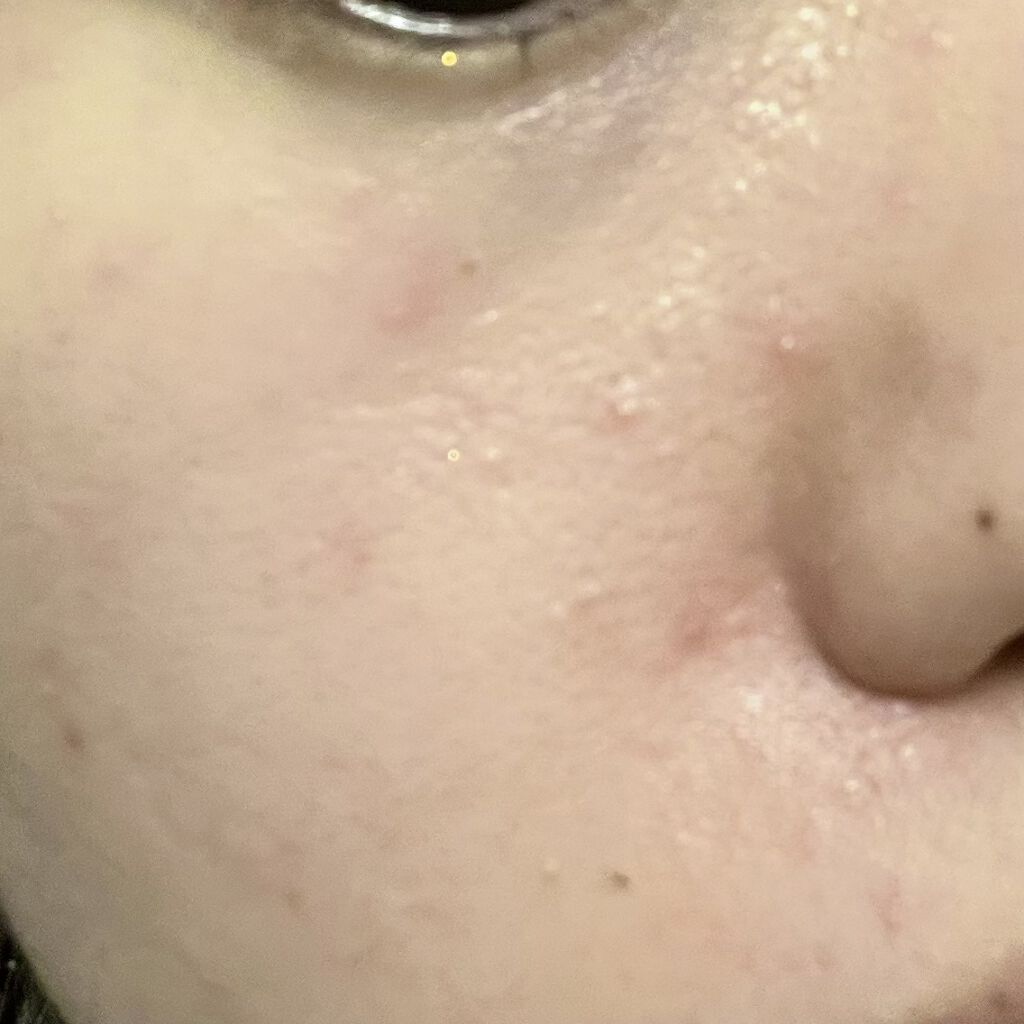 ドクダミ 77 スージングトナー/Anua/化粧水を使ったクチコミ（2枚目）