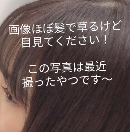 ローヤルゼリー配合 栄養ローション/DAISO/美容液を使ったクチコミ(1枚目)