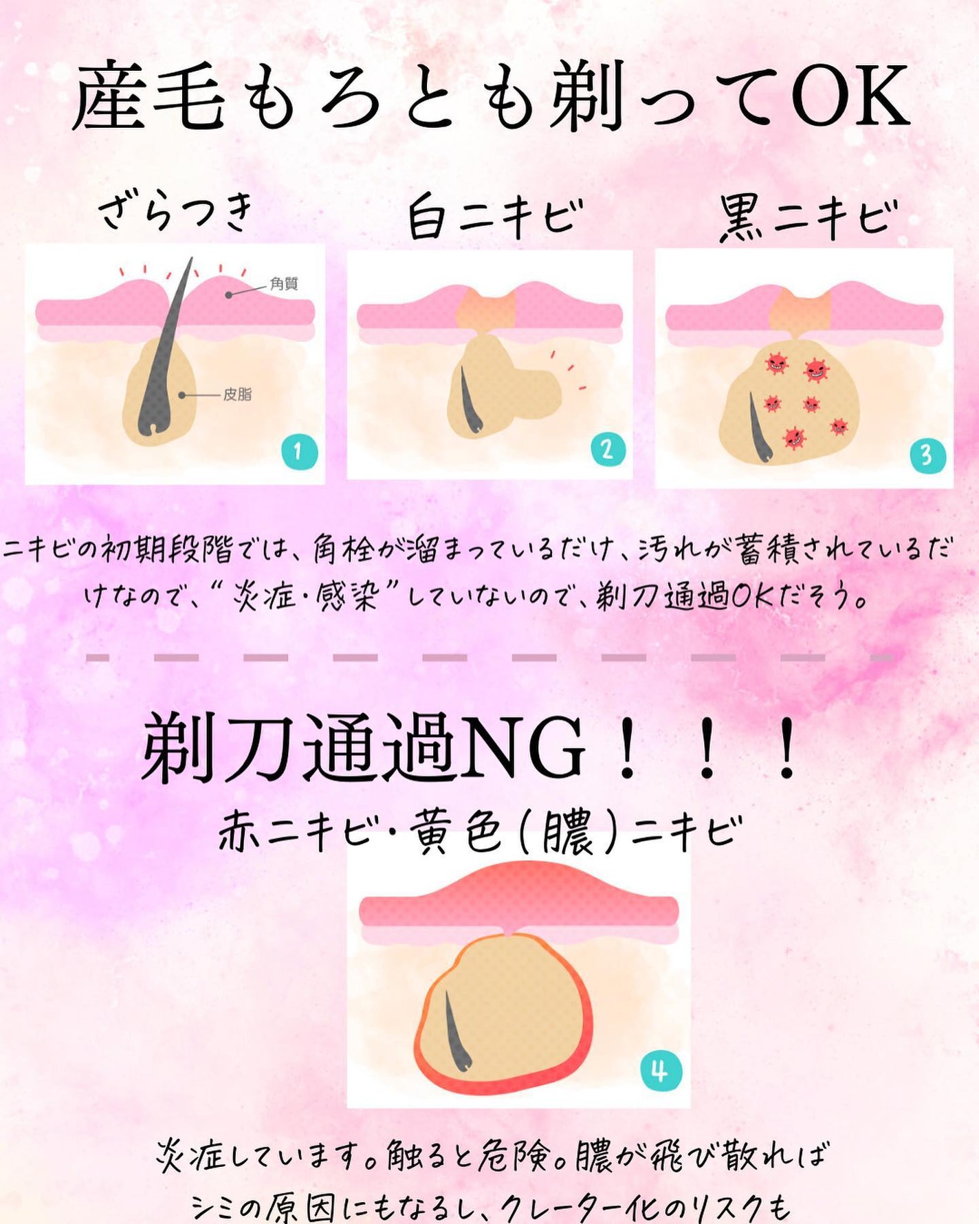 おゆみ|ニキビ・ニキビ跡ケア on LIPS 「@______ohyoume◀︎他の投稿はこちらから💄【顔剃り..」(5枚目)