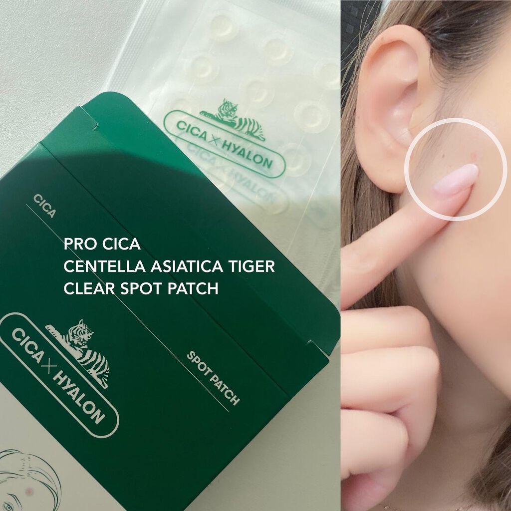 プロCICA クリアスポットパッチ/VT/その他スキンケアを使ったクチコミ(5枚目)