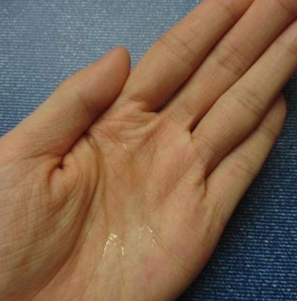 薬用 アクネケア クリアローション/DAISO/化粧水を使ったクチコミ(3枚目)