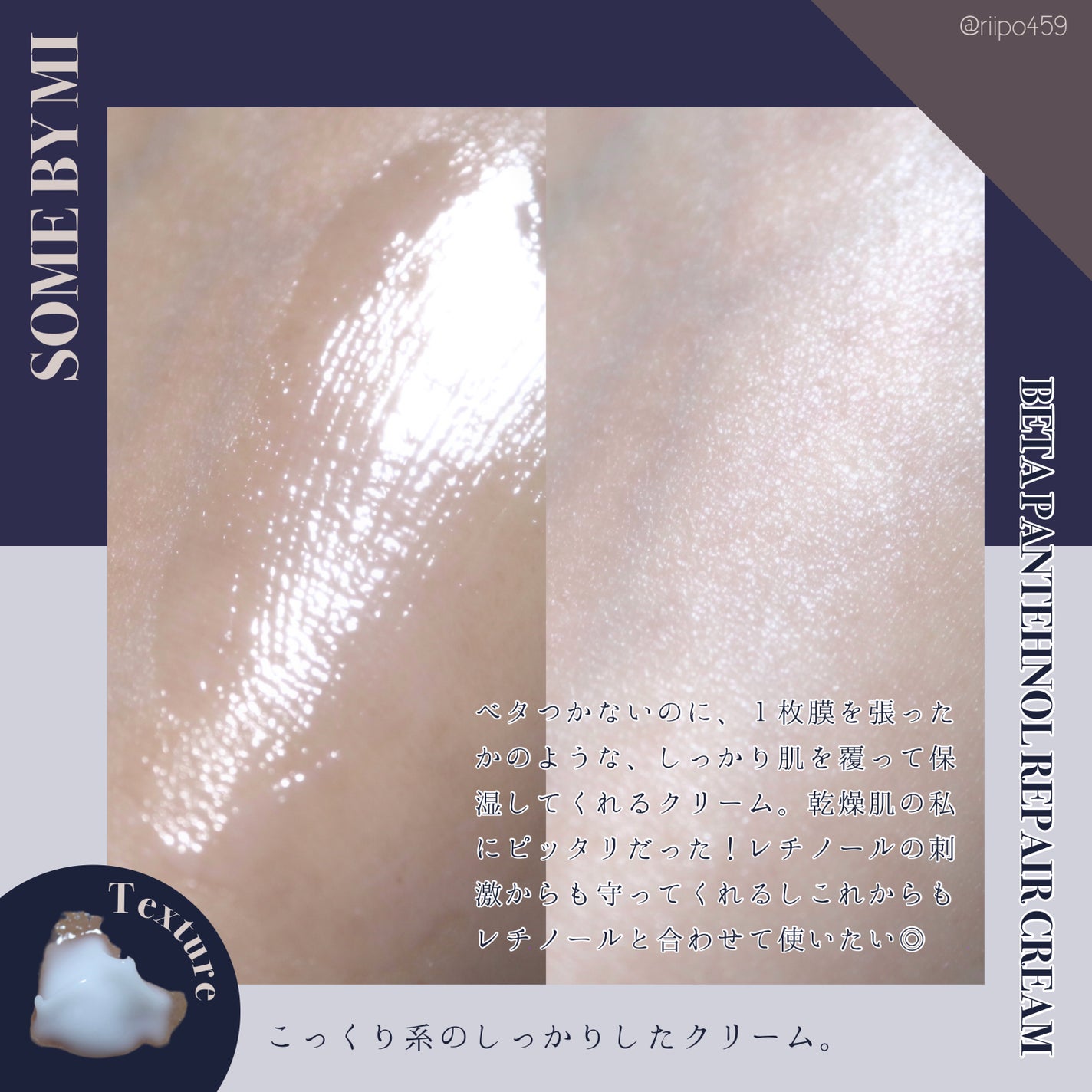 レチノールインテンスリアクティベーションセラム/SOME BY MI/美容液を使ったクチコミ(5枚目)