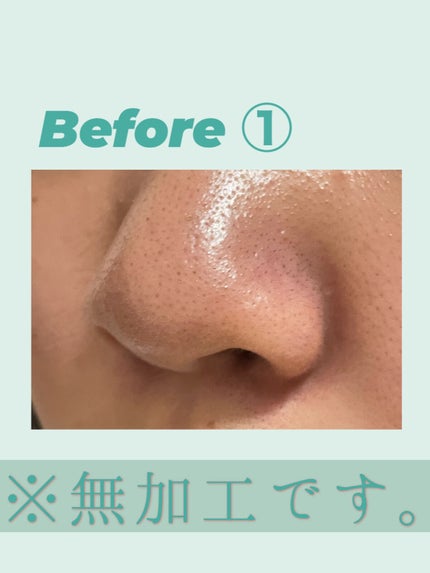 ノーモアブラックヘッド(ノーズピーリング)/One-day's you/スクラブ・ゴマージュを使ったクチコミ(3枚目)