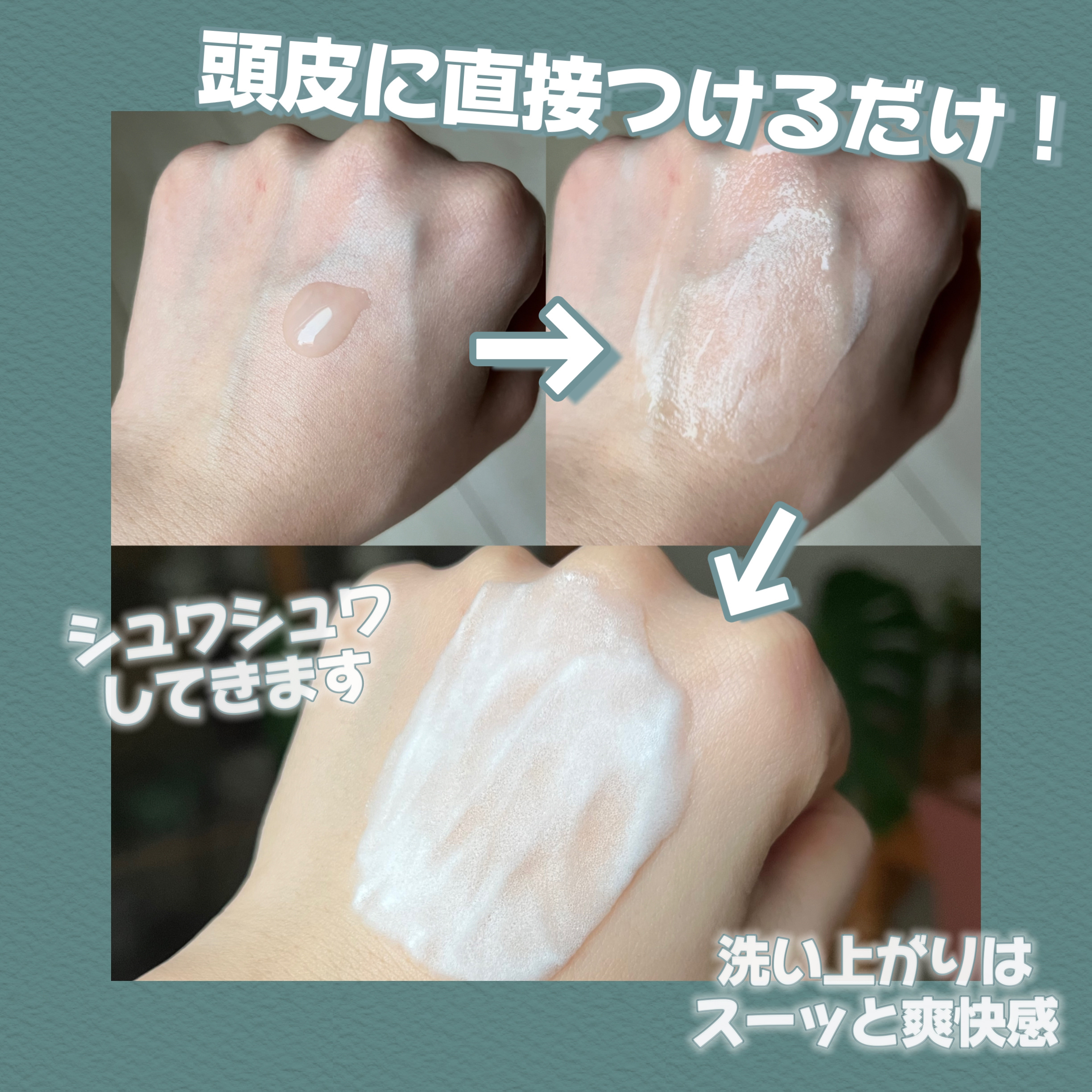 スパークリングスカルプスケーラー/ミンツリー/頭皮ケアを使ったクチコミ（2枚目）