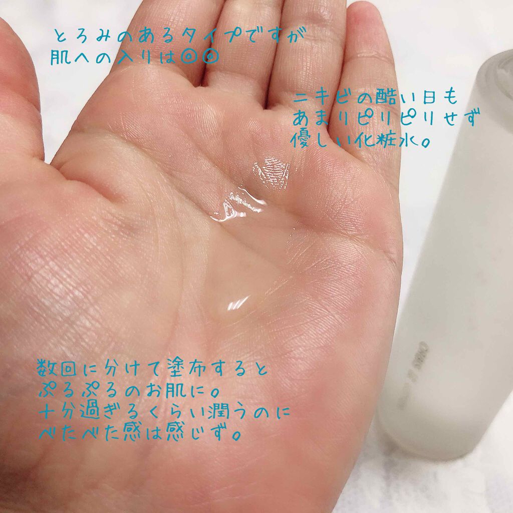 オルビスユー ローション/オルビス/化粧水を使ったクチコミ(2枚目)