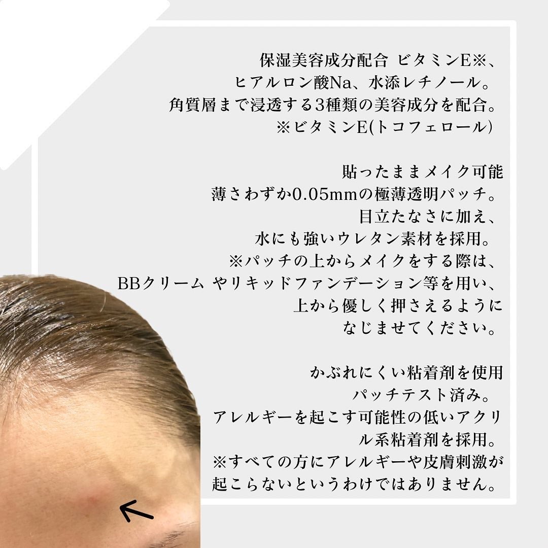 極薄透明パッチ nikipa!/金冠堂/にきびパッチを使ったクチコミ(2枚目)