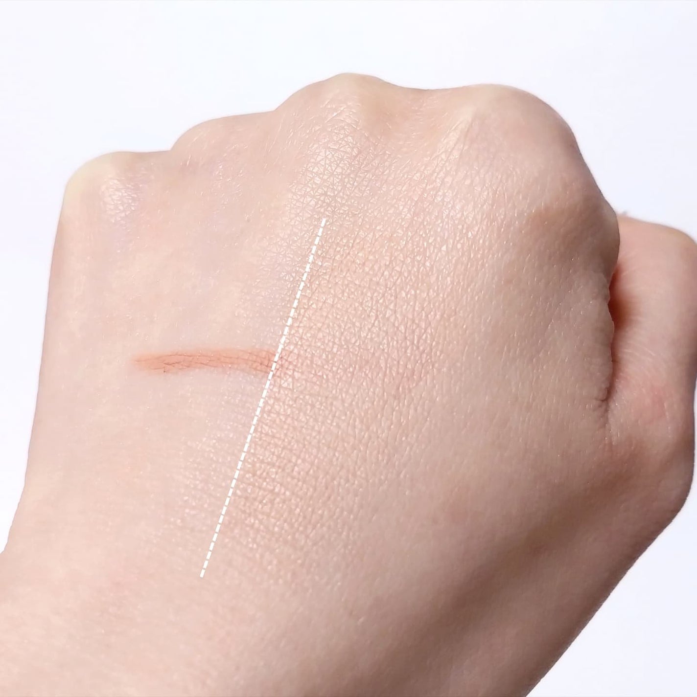 薬用スポットシーラークリーム/スキンヒーロー/クリームコンシーラーを使ったクチコミ(4枚目)