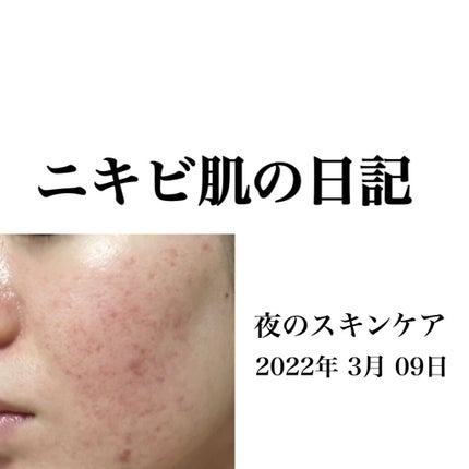 オートマイルドモイスチャーインテンシブローション/innisfree/乳液を使ったクチコミ(1枚目)