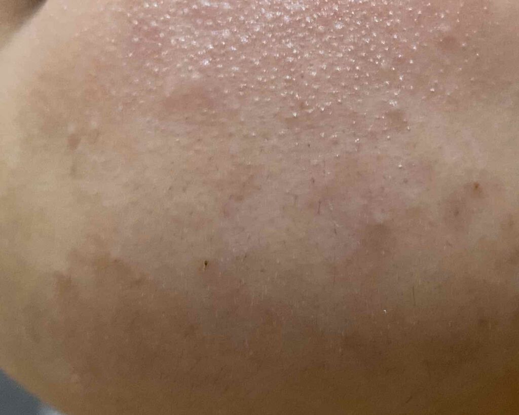 敏感肌用薬用美白美容液/無印良品/美容液を使ったクチコミ(4枚目)
