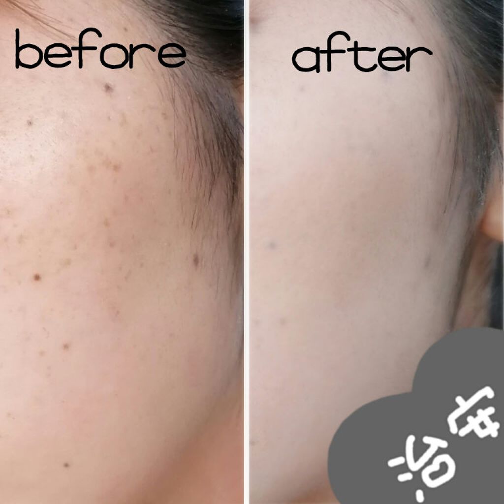 カバーパーフェクション チップコンシーラー/the SAEM/リキッドコンシーラーを使ったクチコミ(3枚目)