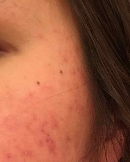 薬用保湿化粧水/オードムーゲ/化粧水を使ったクチコミ(3枚目)