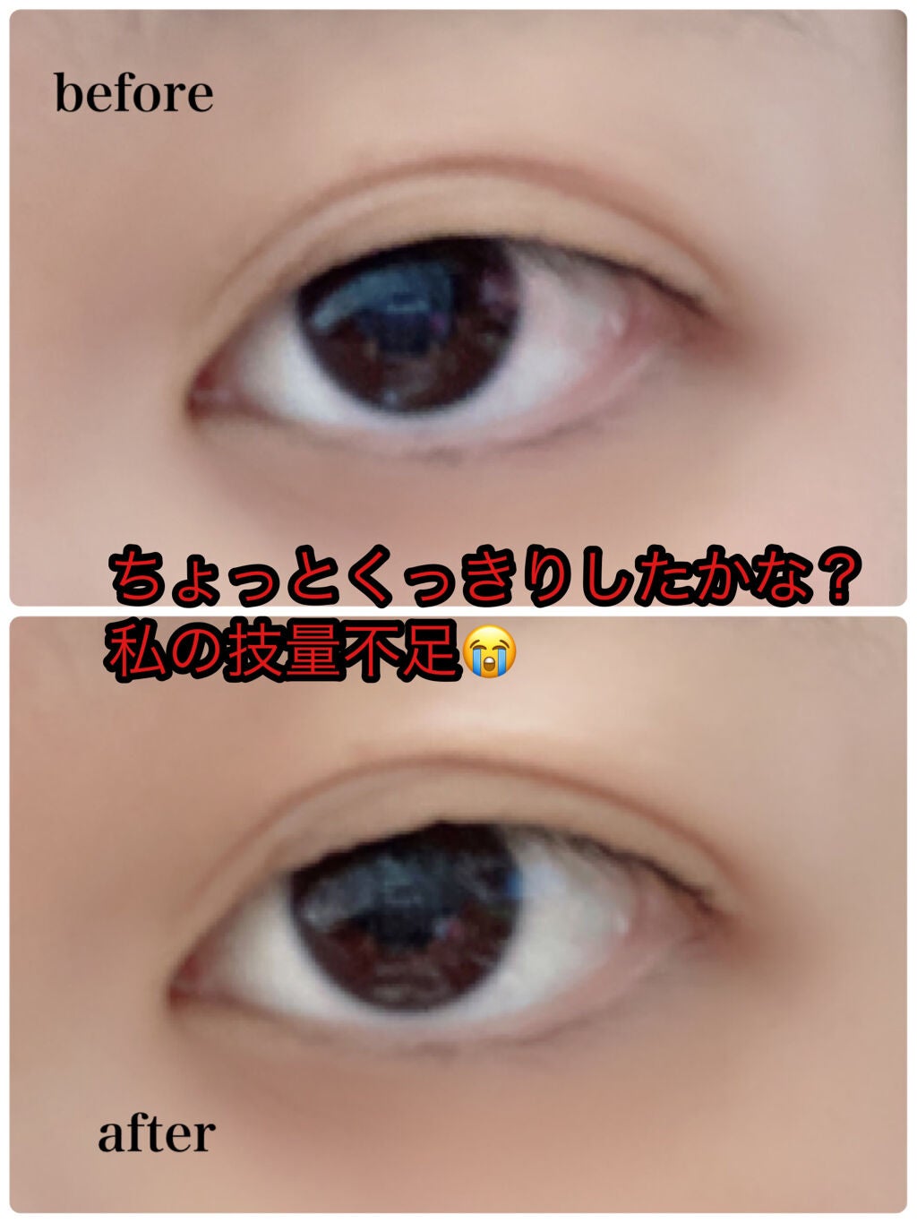 ãªãªã·ã ã¢ã€ãªããã¹ãã³ãã£ã«ã /D-UP/äºéãŸã¶ãçšã¢ã€ãã ã䜿ã£ãã¯ãã³ãïŒ4æç®ïŒ