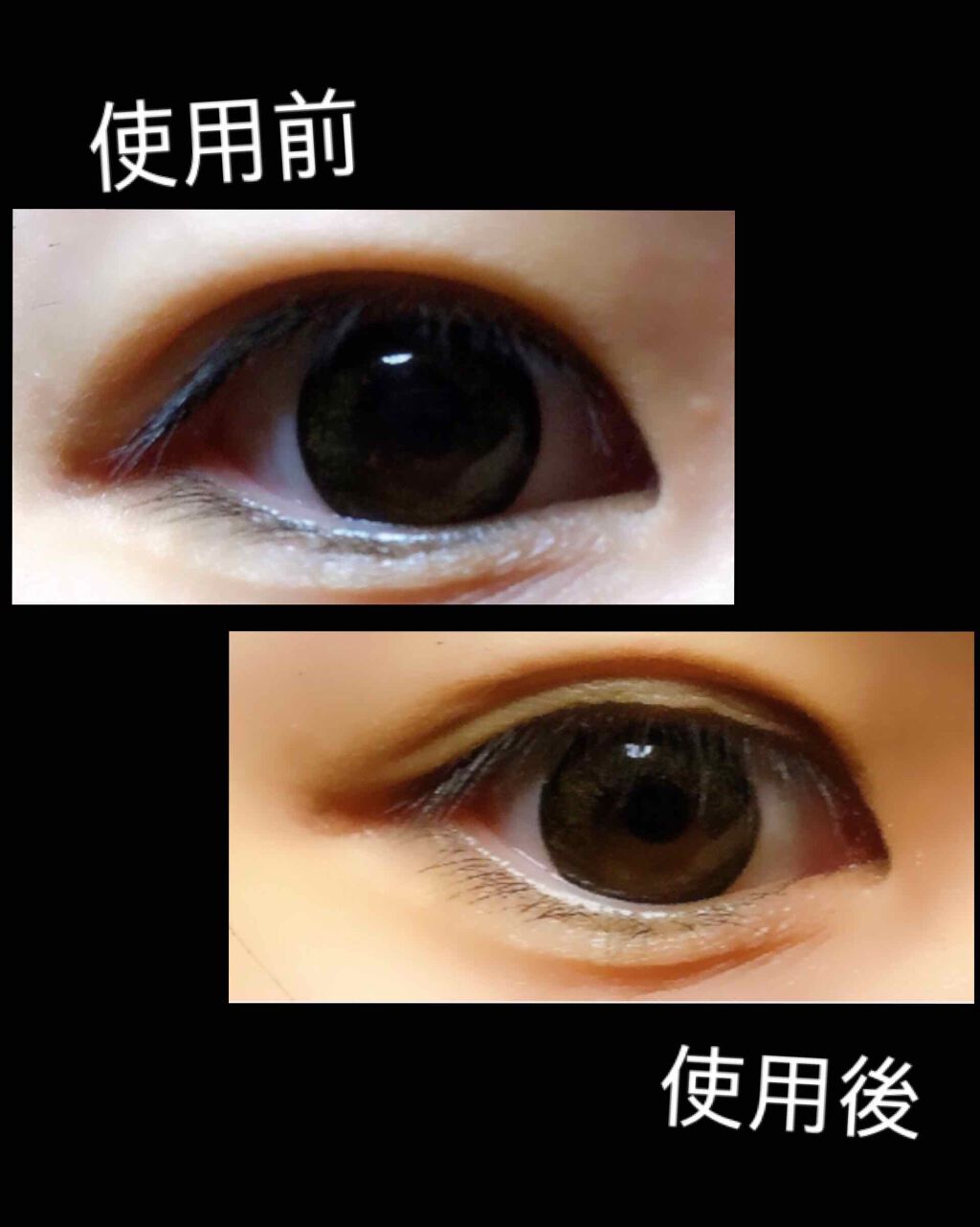 カンタン80/メザイク/二重まぶた用アイテムを使ったクチコミ（2枚目）