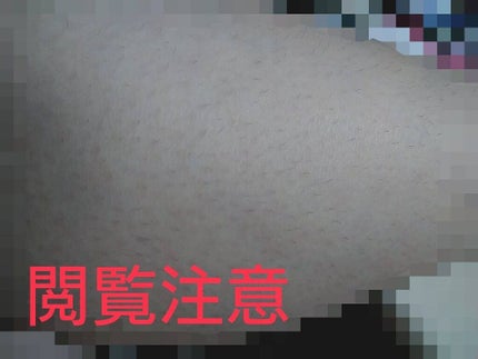 モテ肌  除毛パッド/セリア/ムダ毛ケアを使ったクチコミ(3枚目)