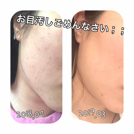 美白美容液 W/ちふれ/美容液を使ったクチコミ(3枚目)