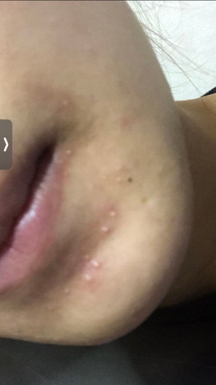 ACアクティブ フェイスローション モイスト/NOV/化粧水を使ったクチコミ(1枚目)