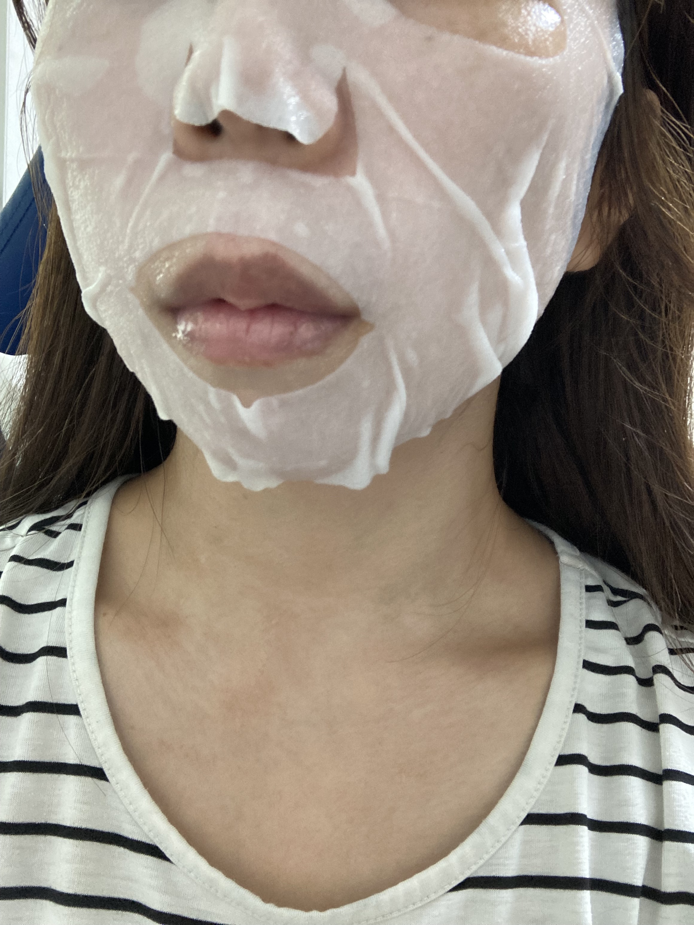 弱酸性PHシートマスク 復活草フィット/Abib /シートマスク・パックを使ったクチコミ（2枚目）